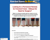 Knocked Knees No Extra – The right way to Straighten Your Legs With out Surgical procedure!